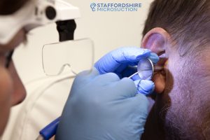How Regular Ear Wax Removal Appointments in Stoke on Trent and Staffordshire Protect Your Ear Health