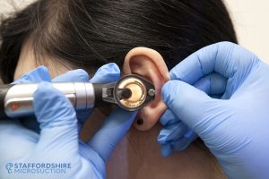 How do you know if you need ear wax removal?